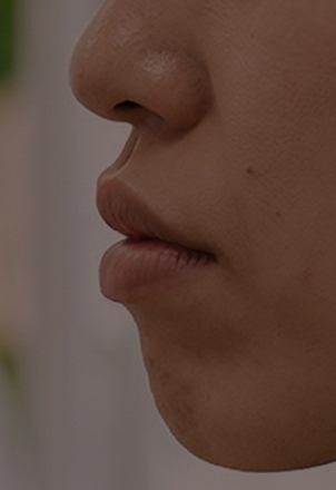 청소년 · 성인 교정